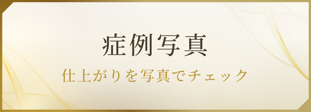 症例写真