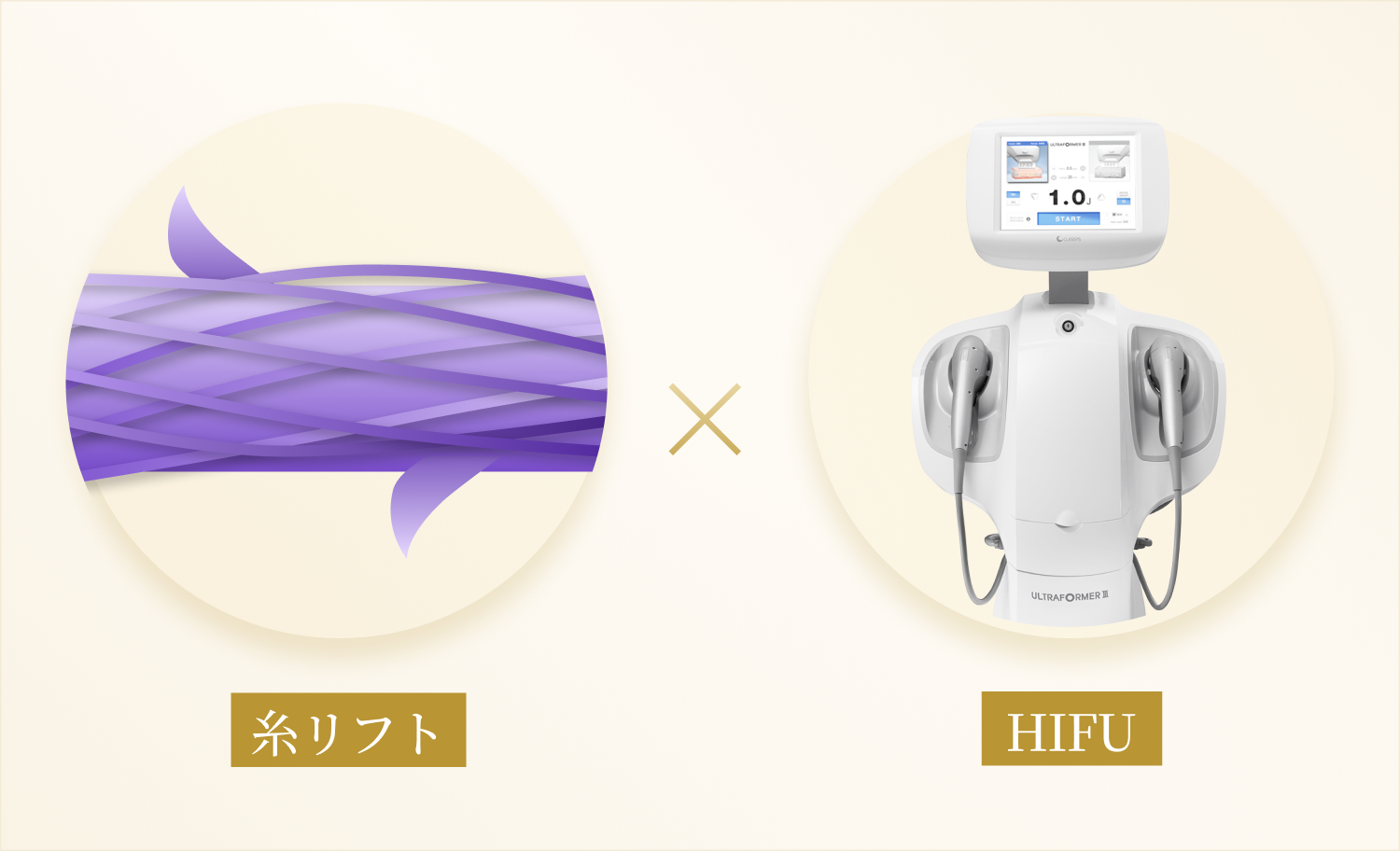 糸リフトとHIFU