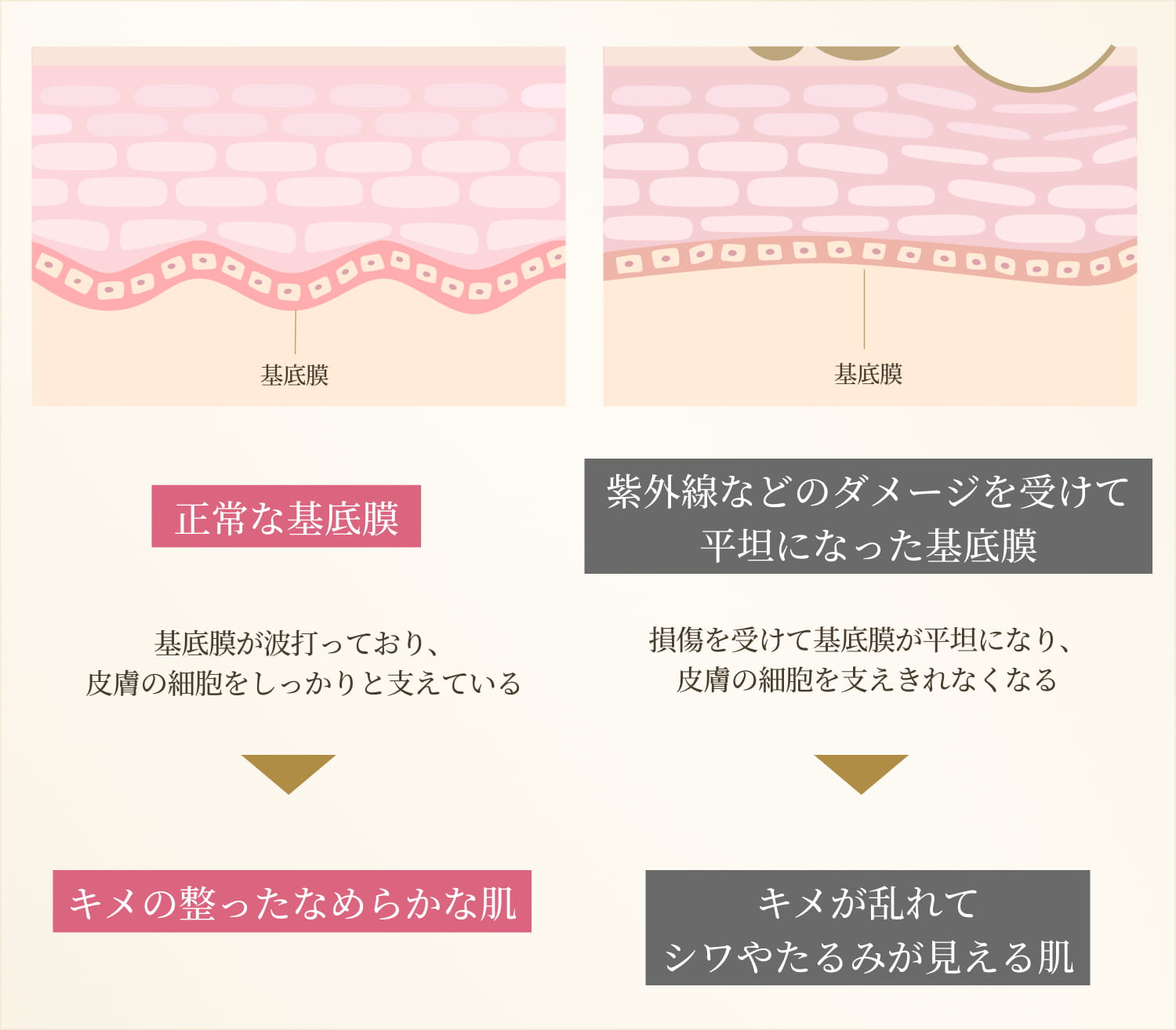 正常な基底膜とダメージを受けた基底膜の比較図
