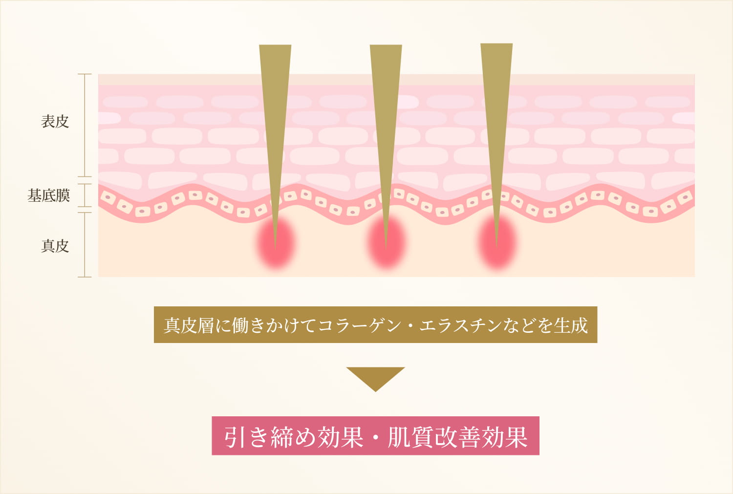 引き締めと肌質改善のメカニズム
