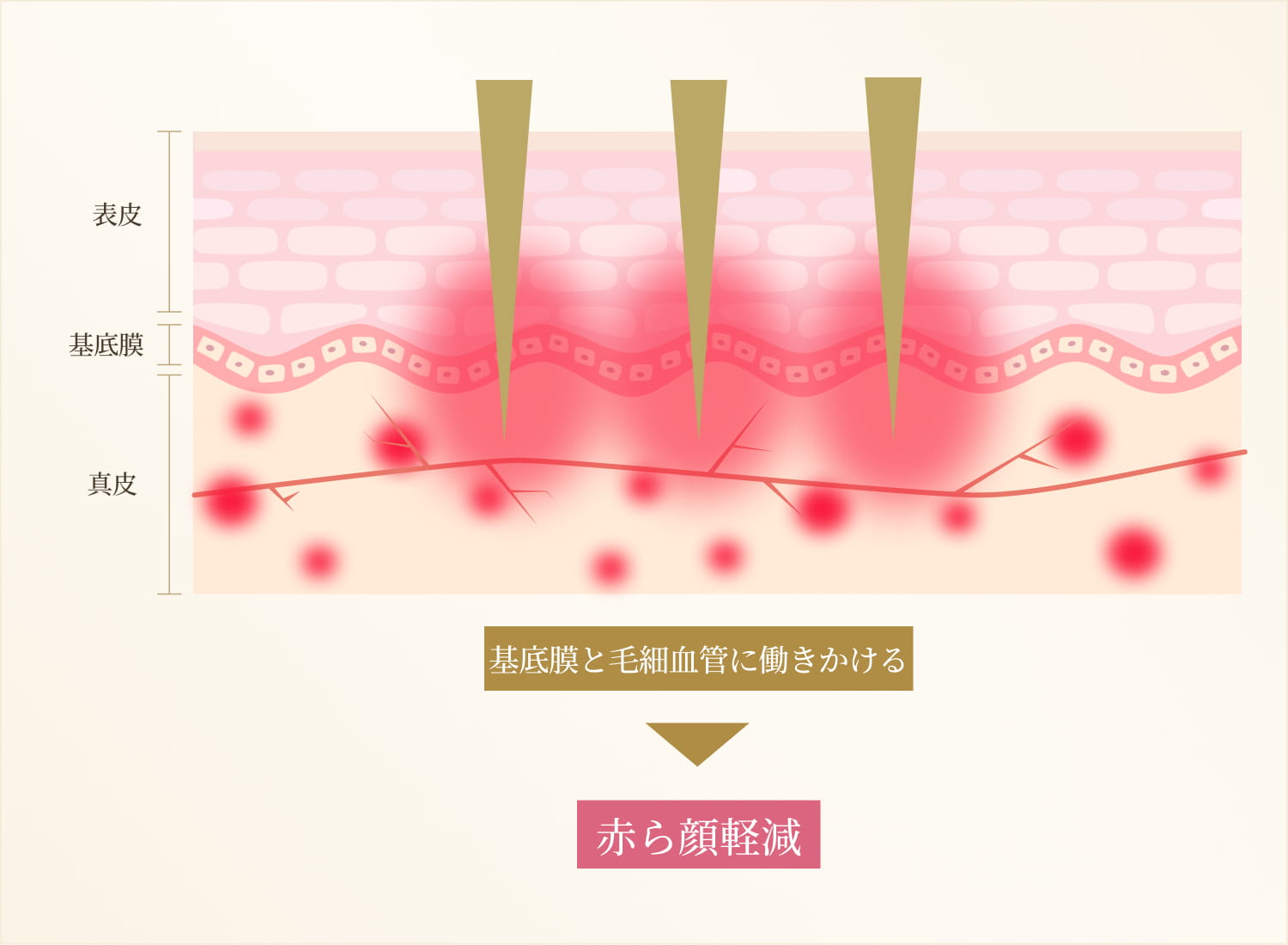赤ら顔軽減のメカニズムを示すシェーマ画像
