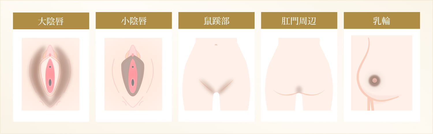 黒ずみ改善（トーンアップ）