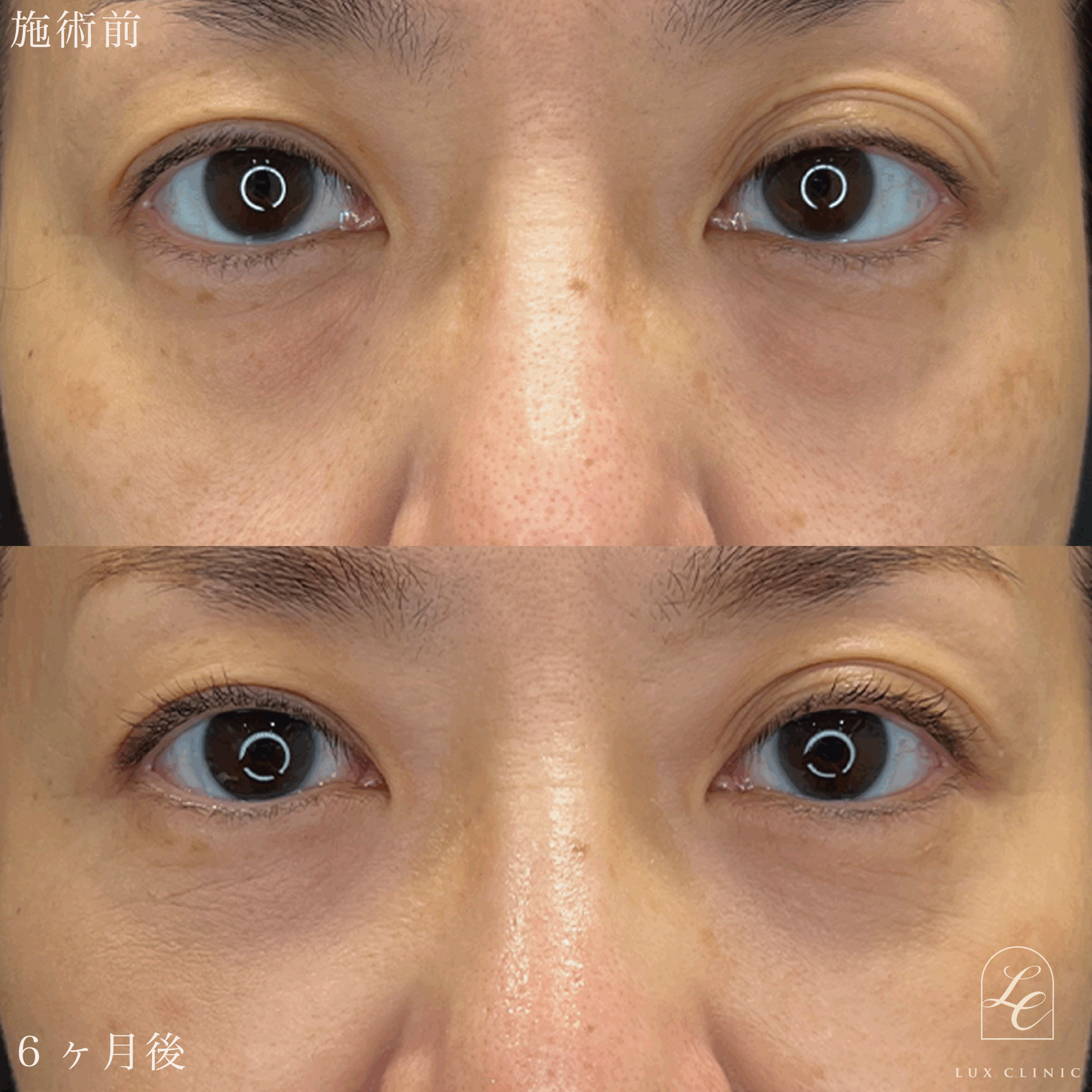 症例写真2