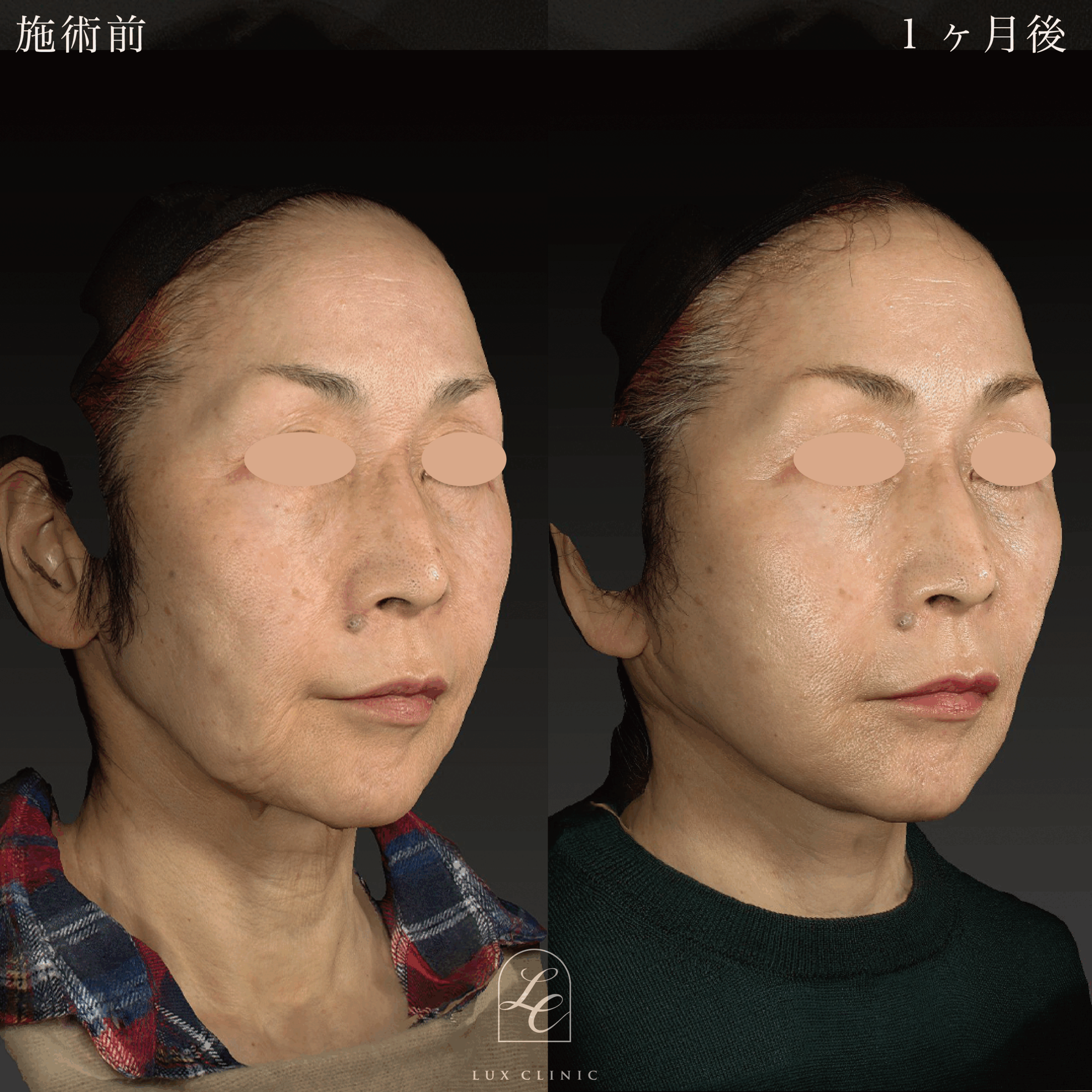 症例写真2