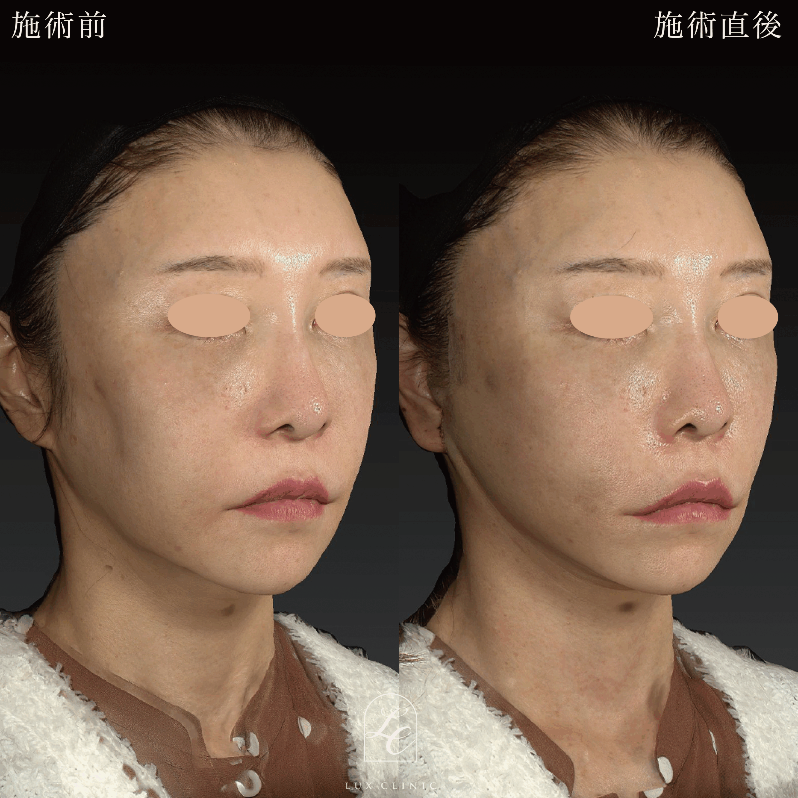 症例写真1