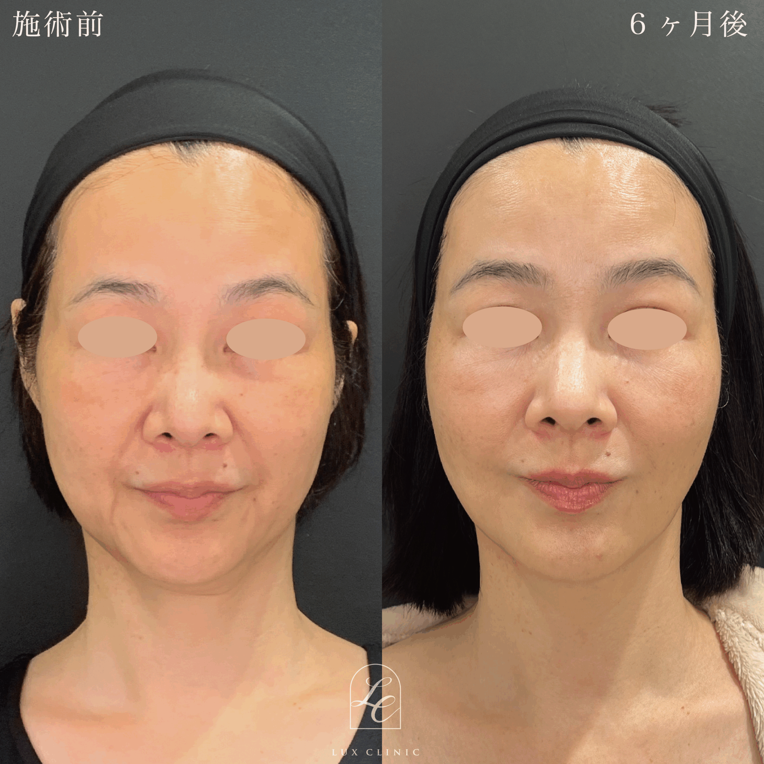 症例写真2