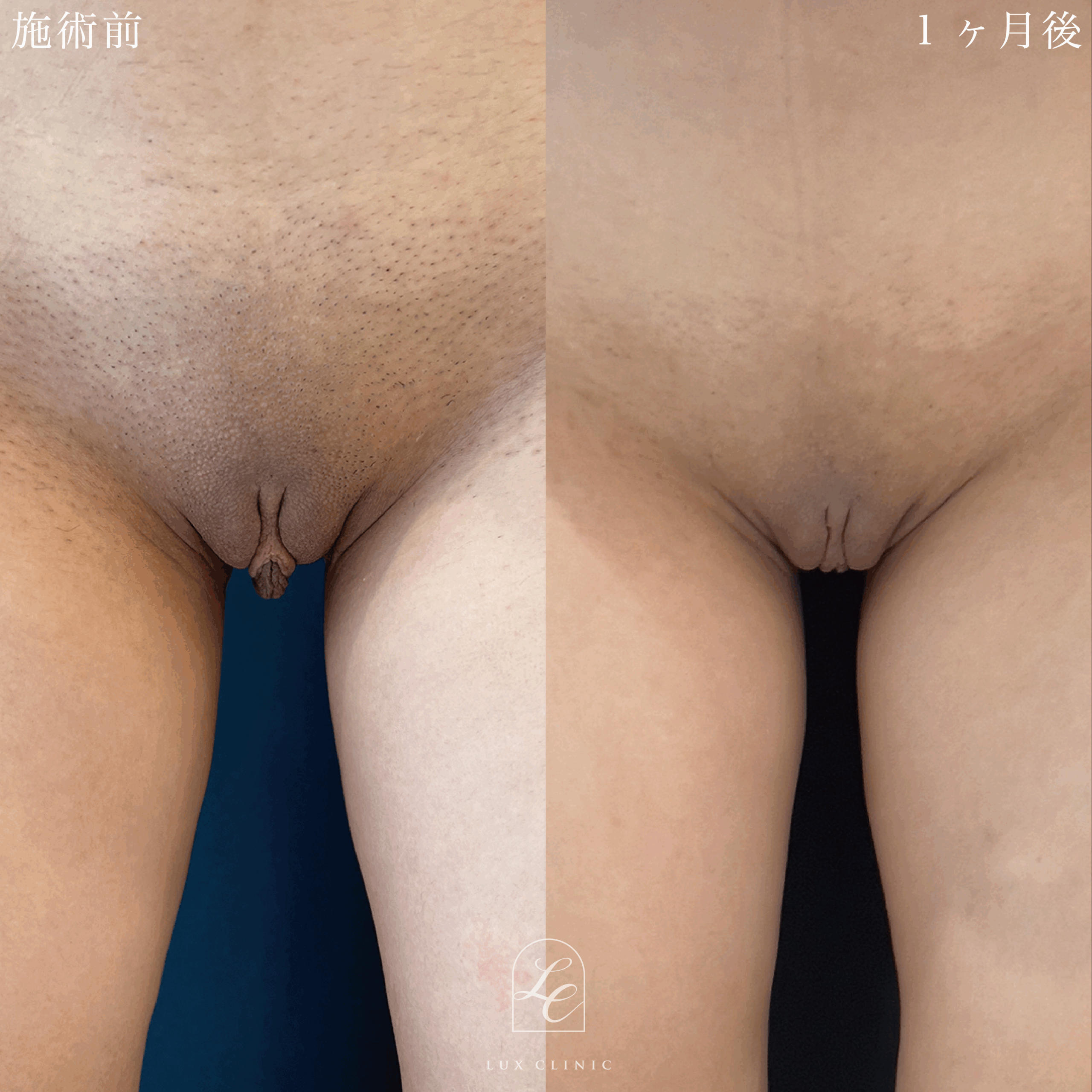症例写真1