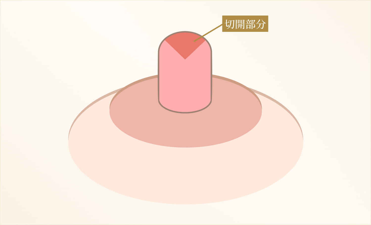 高さ、大きさを縮小